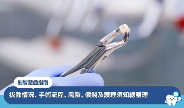 剝智慧齒指南