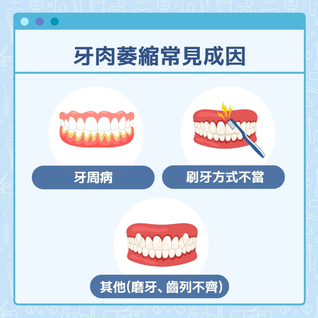 牙肉萎縮常見成因