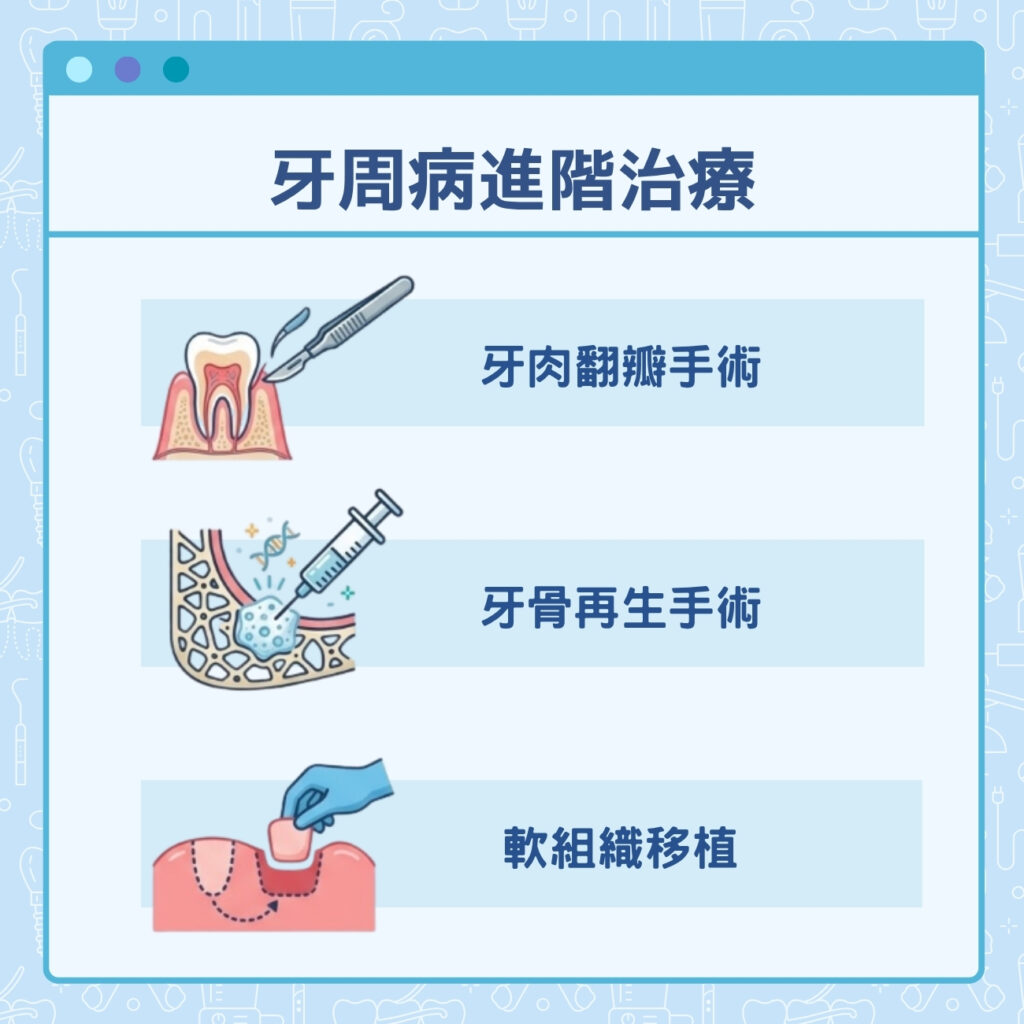 牙周病進階治療