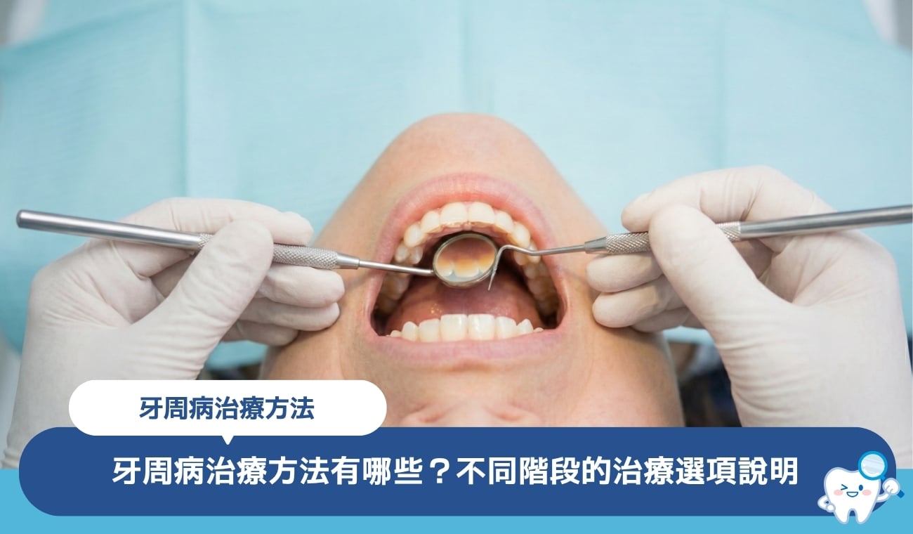 牙周病治療方法有哪些?