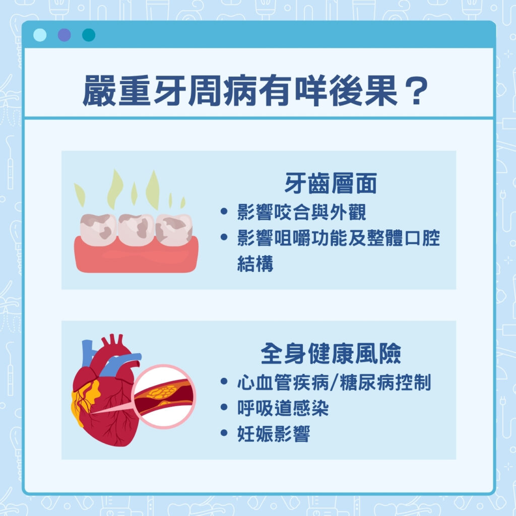 嚴重牙周病有咩後果?
