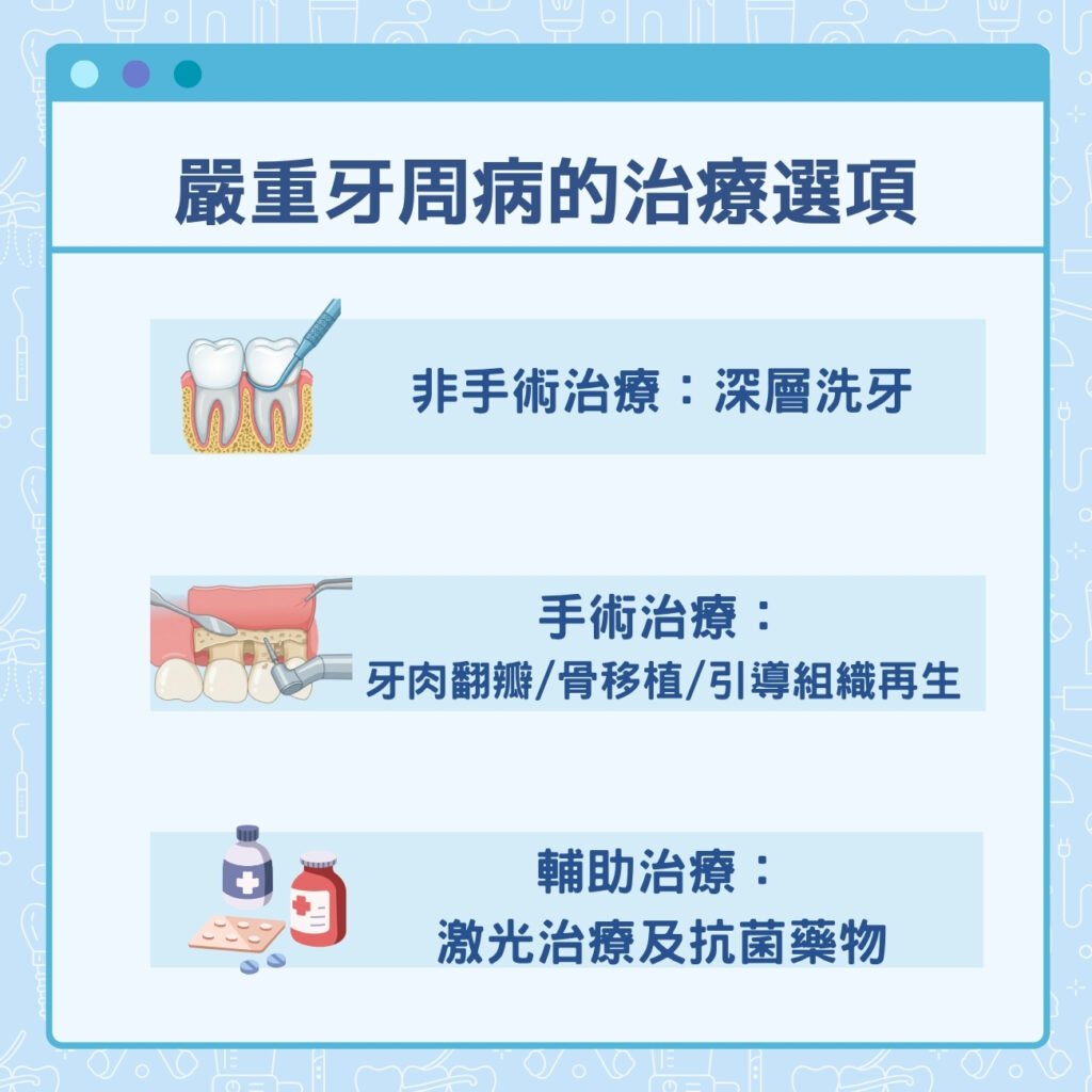 嚴重牙周病的治療選項