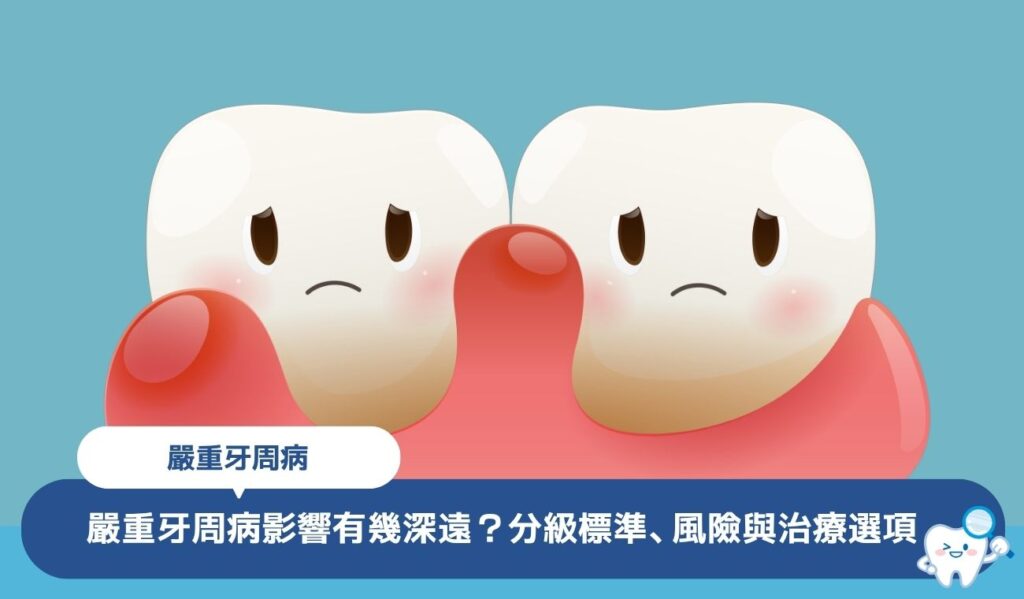 嚴重牙周病影響有幾深遠?專業牙醫解釋分級標準、風險與治療選項