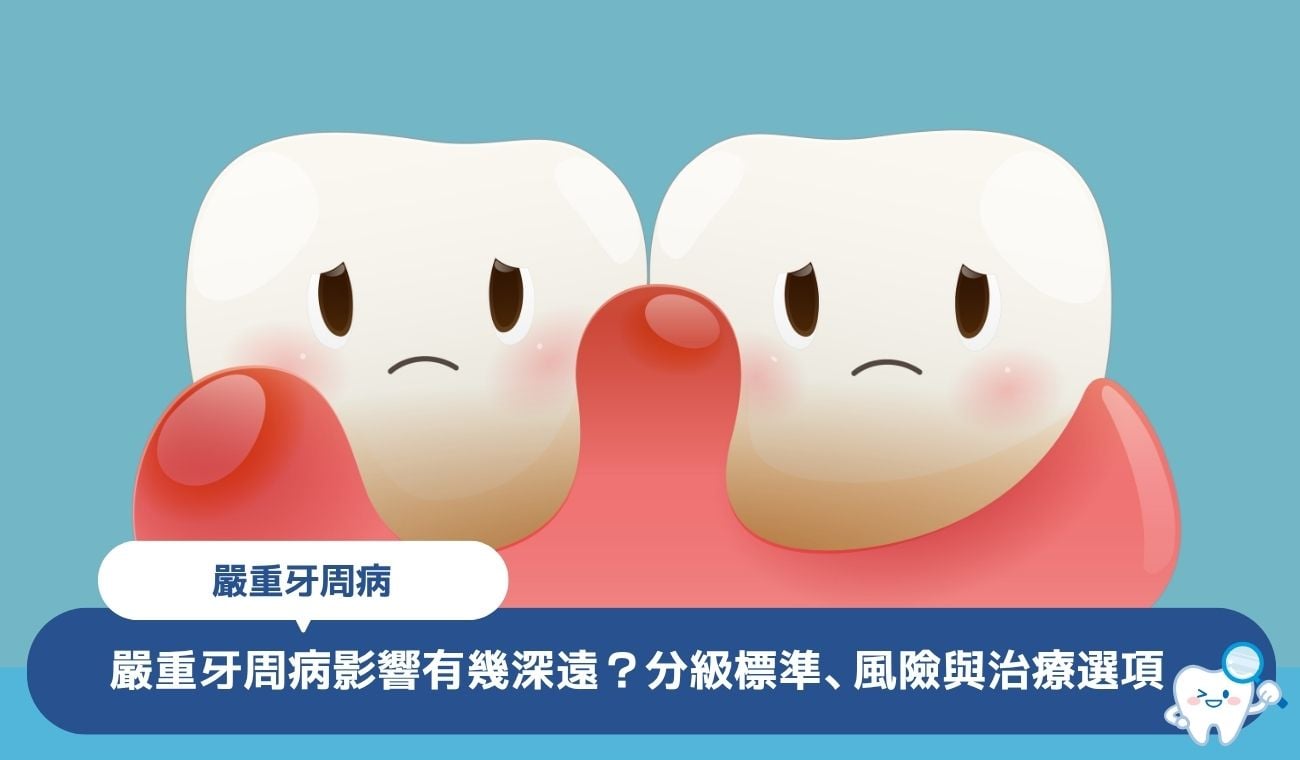 嚴重牙周病影響有幾深遠?專業牙醫解釋分級標準、風險與治療選項