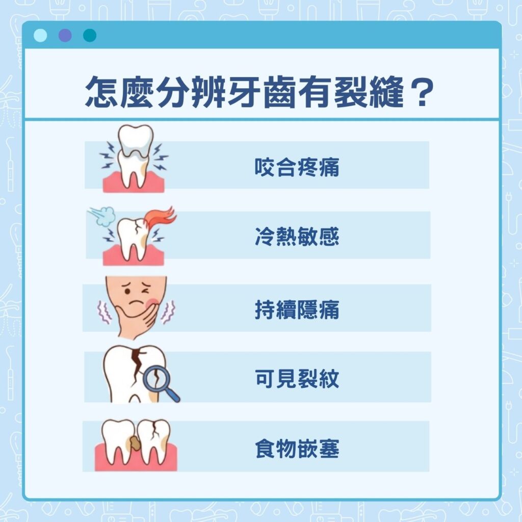怎麼分辨牙齒有裂縫?