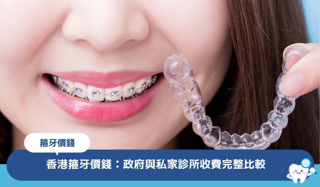 香港箍牙價錢幾多?政府箍牙 vs 私家診所完整比較