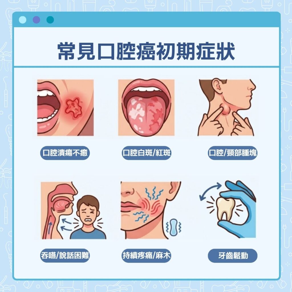 常見口腔癌初期症狀