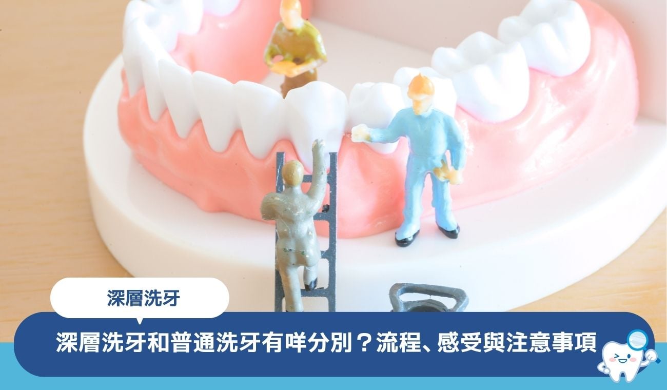 深層洗牙是什麼?和普通洗牙有咩分別?流程、感受一次講清