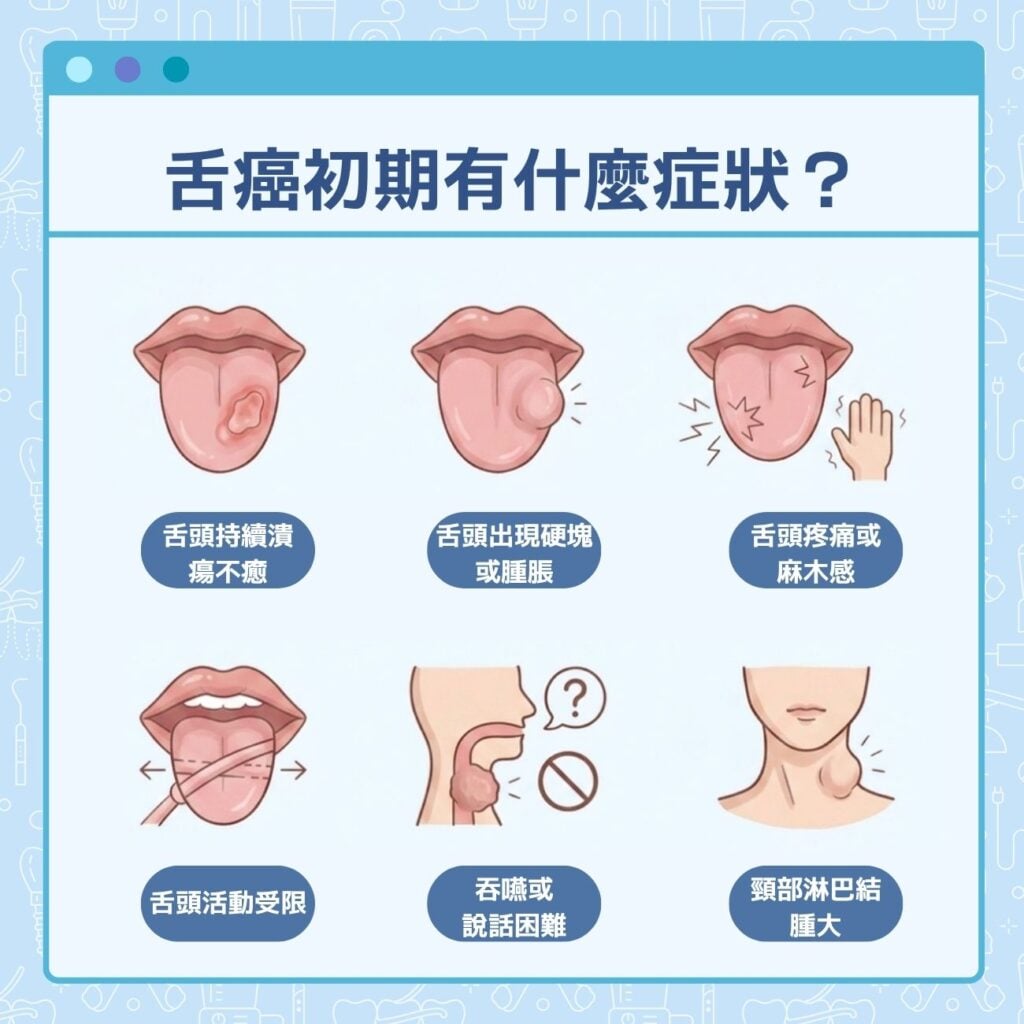 舌癌初期有什麼症狀?