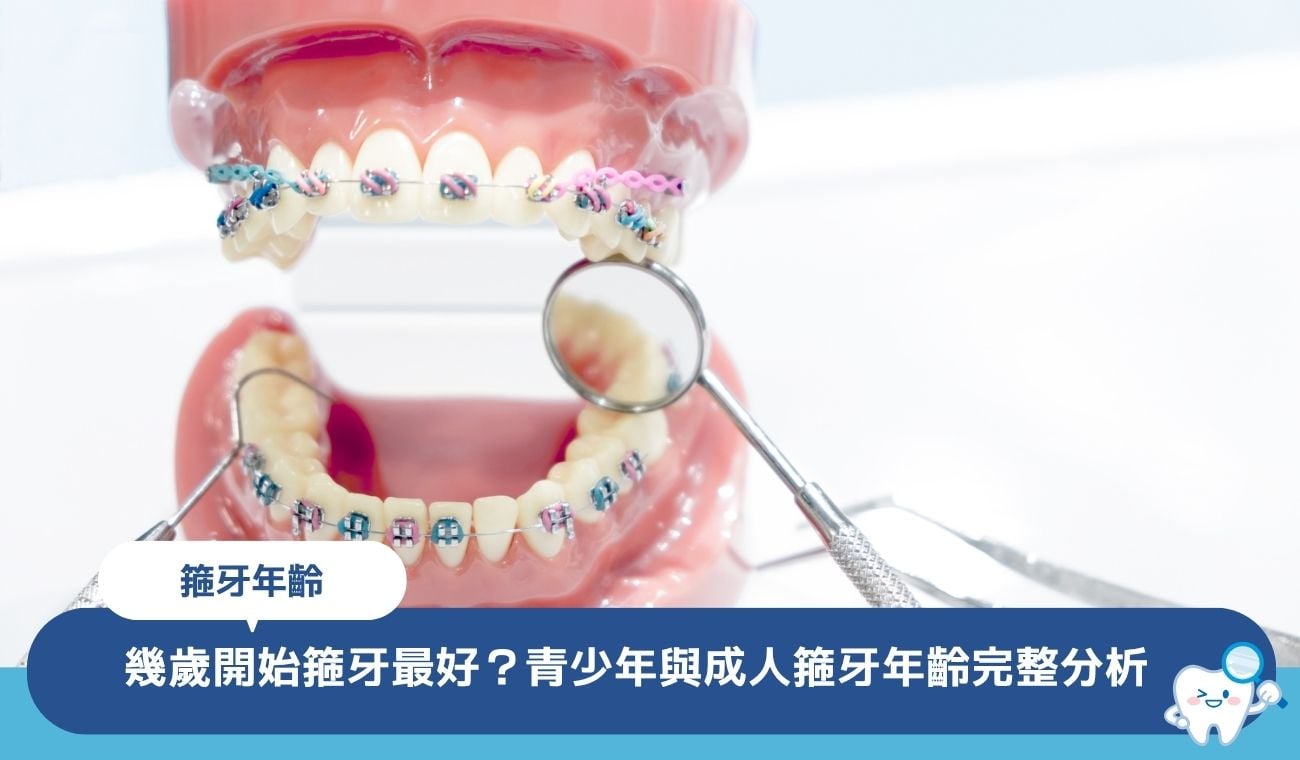 幾歲開始箍牙最好?兒童、青少年與成人箍牙年齡時機分析