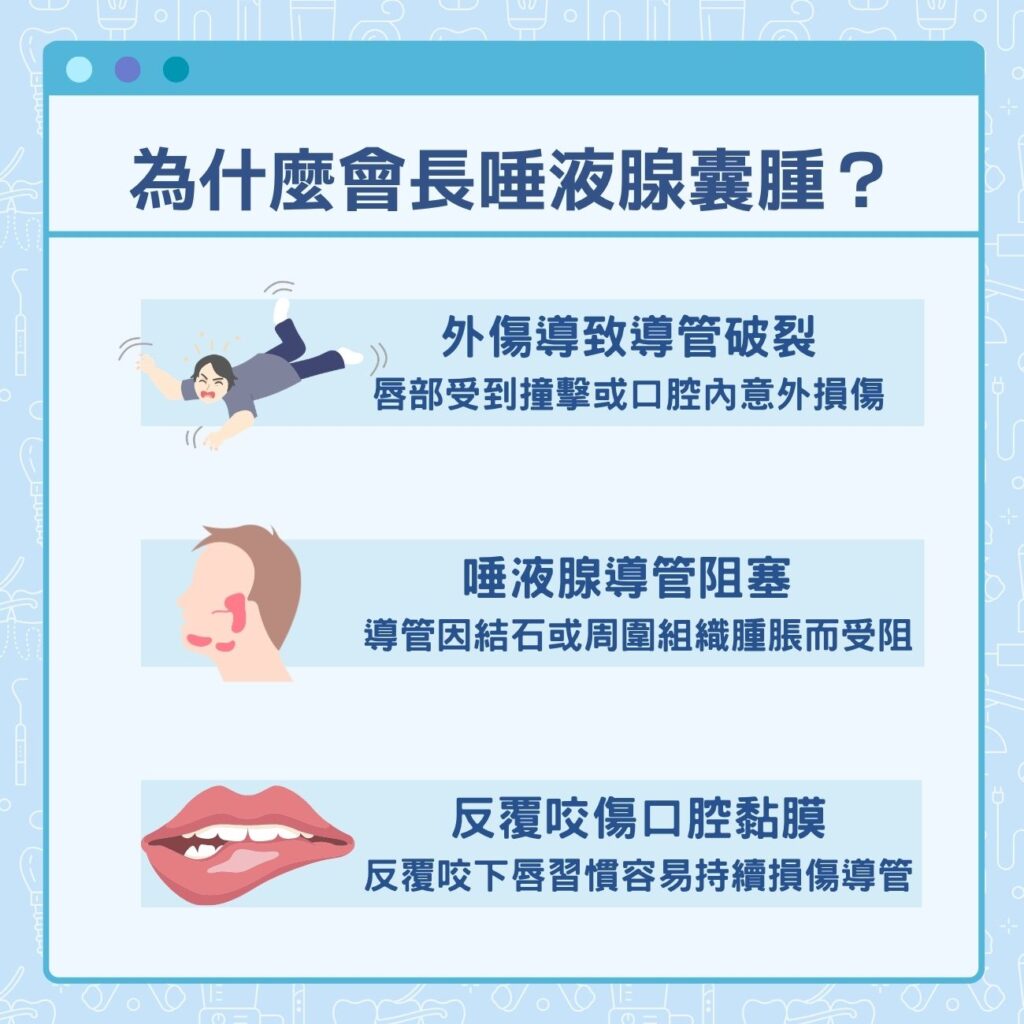 為什麼會口水腺腫脹?唾液腺囊腫的成因
