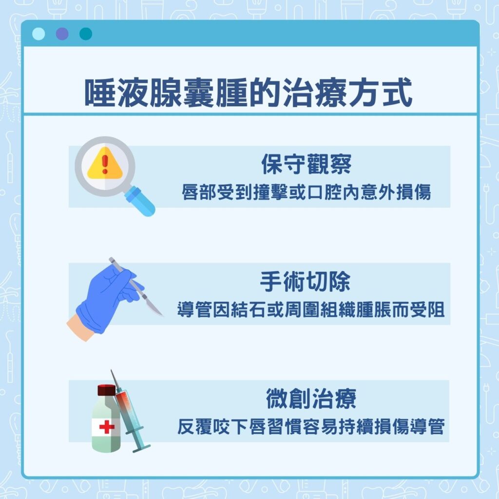 唾液腺囊腫的治療方式