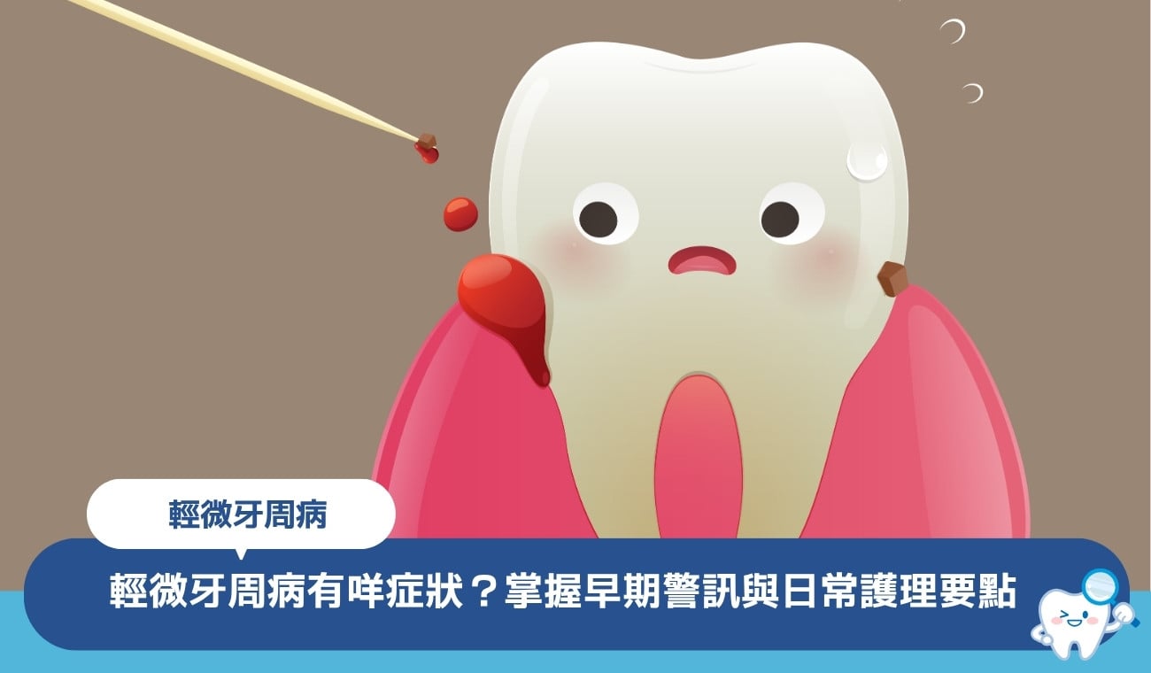 輕微牙周病有咩症狀?掌握5大早期警訊與日常護理要點