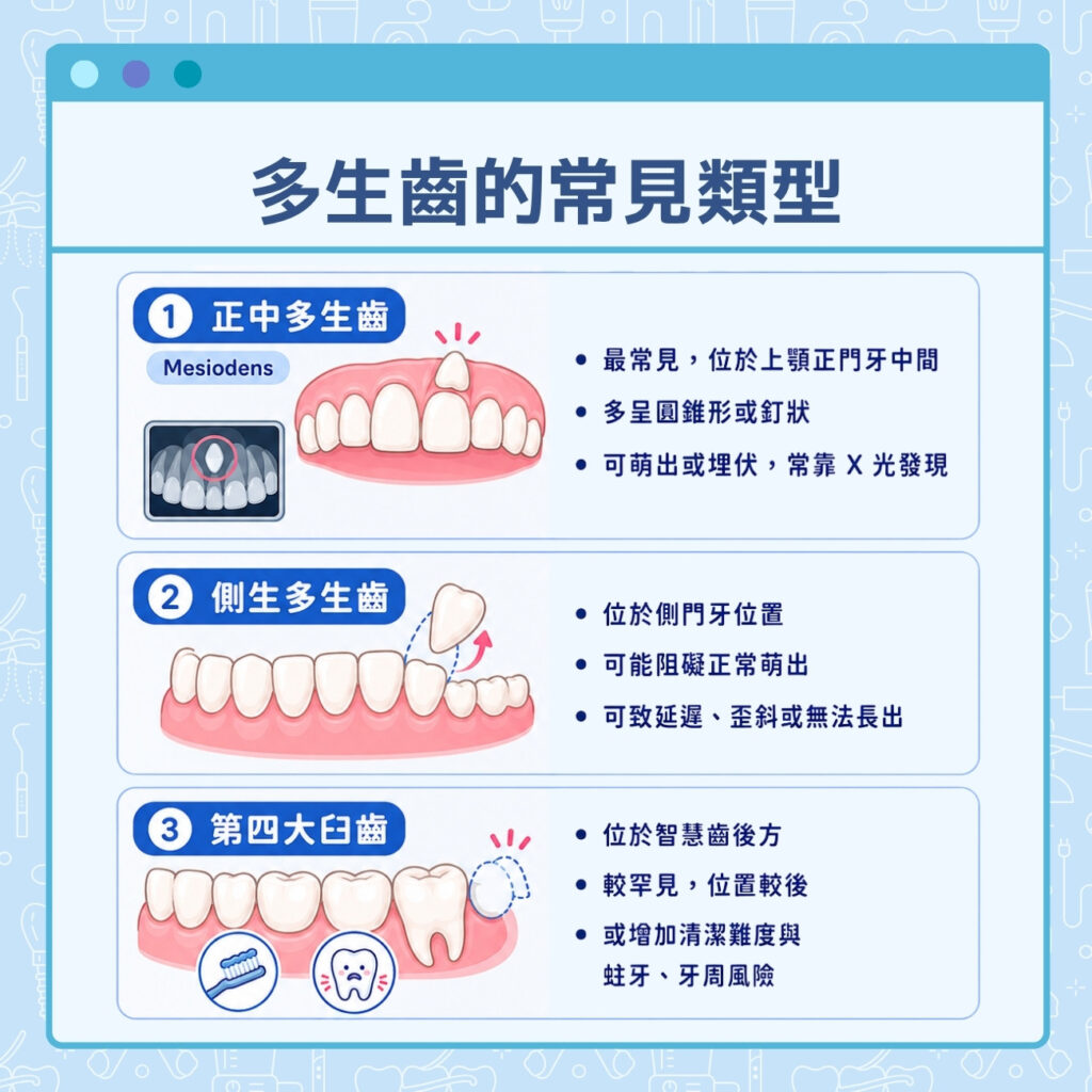多生齒的常見類型