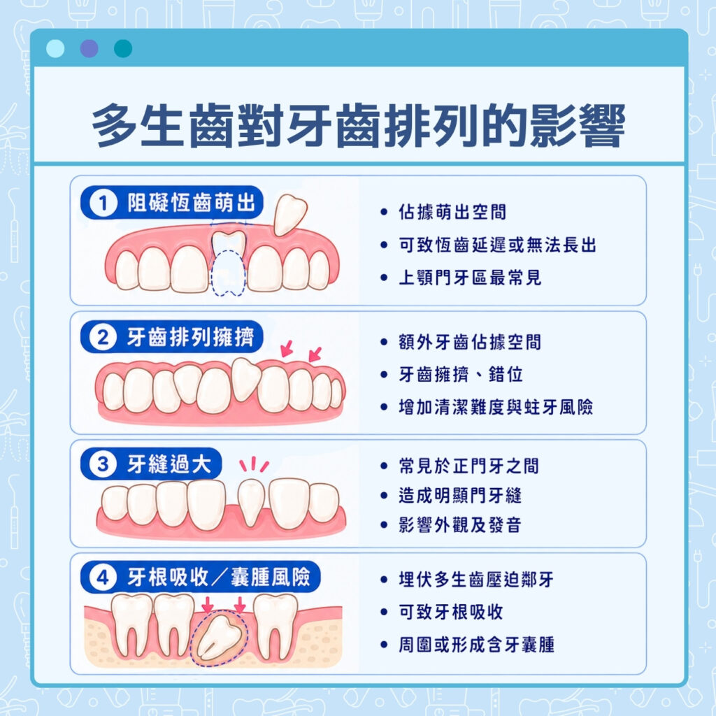 多生齒對牙齒排列的影響