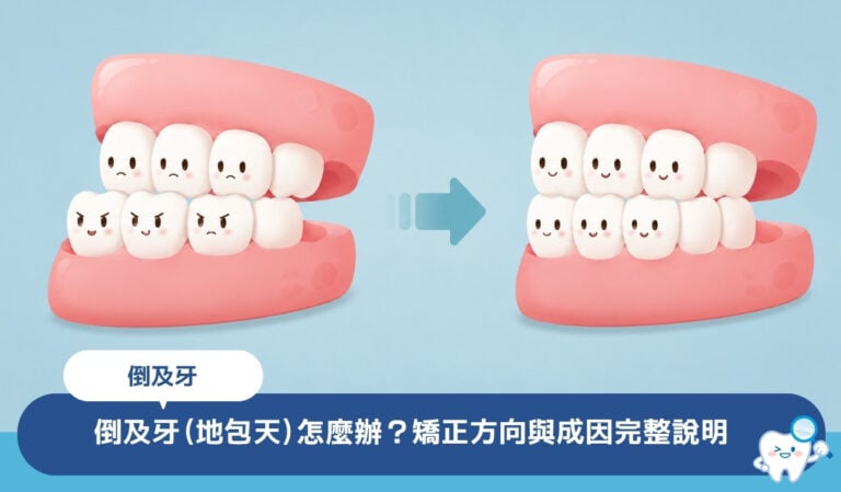 倒及牙（地包天）怎麼辦？4 種矯正方向與成因完整說明
