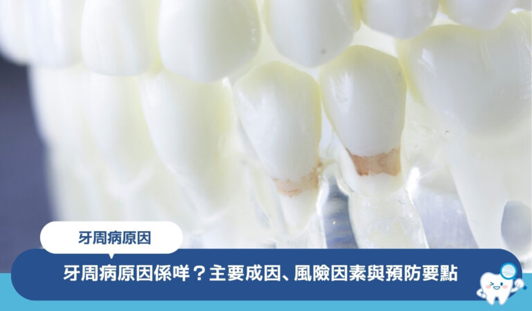 牙周病原因係咩？6大主要成因、常被忽略的風險因素與預防要點