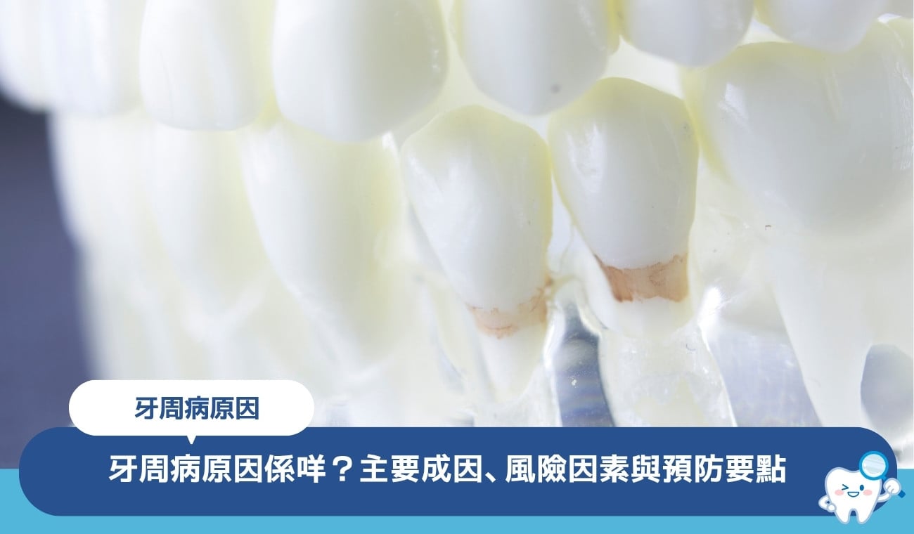 牙周病原因係咩?6大主要成因、常被忽略的風險因素與預防要點