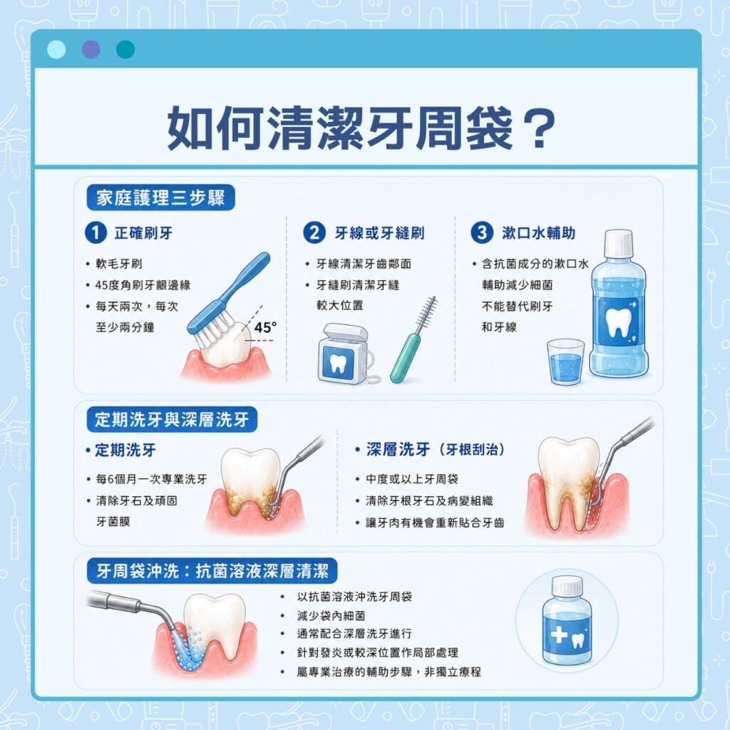 如何清潔牙周袋?
